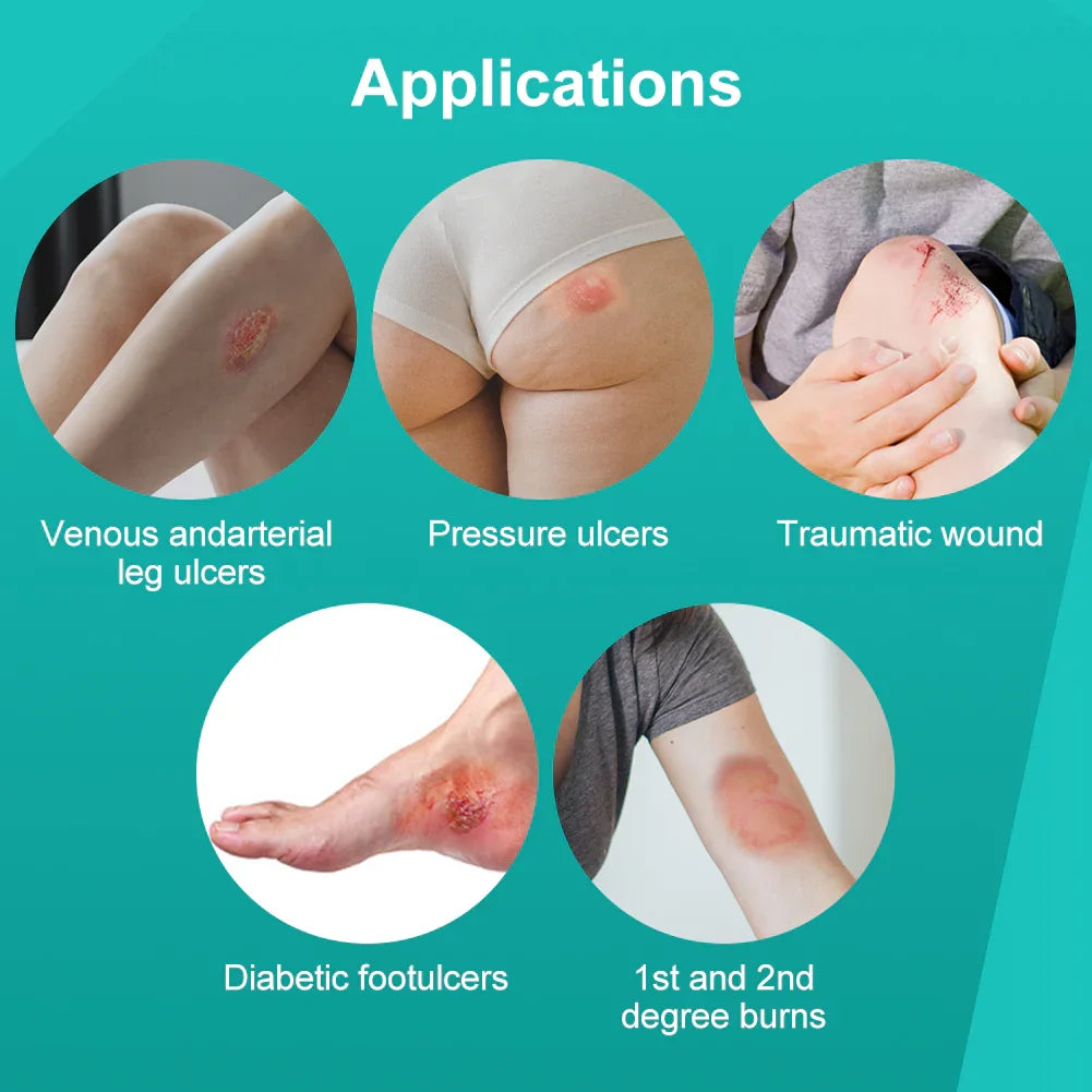 Various wound care applications including leg ulcers, pressure ulcers, traumatic wounds, diabetic foot ulcers, and burns