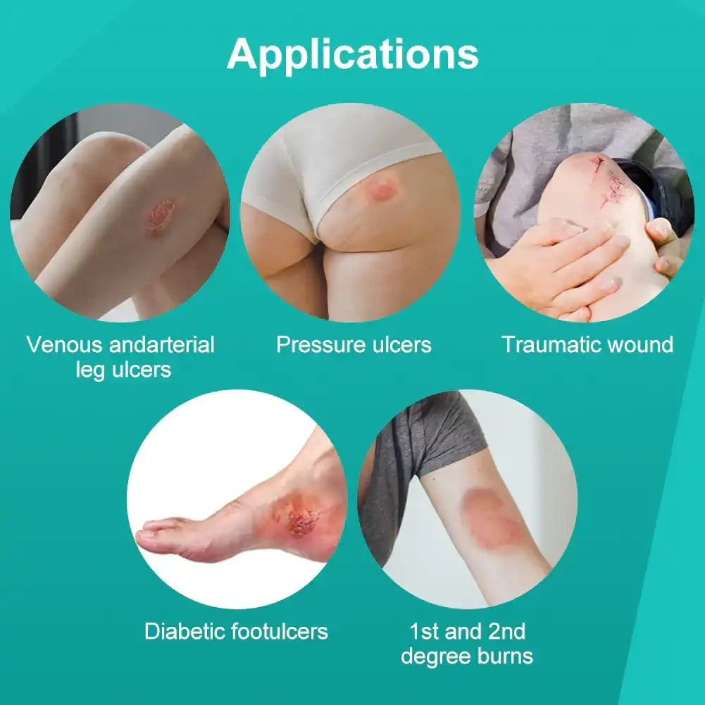 Various wound care applications including leg ulcers, pressure ulcers, traumatic wounds, diabetic foot ulcers, and burns