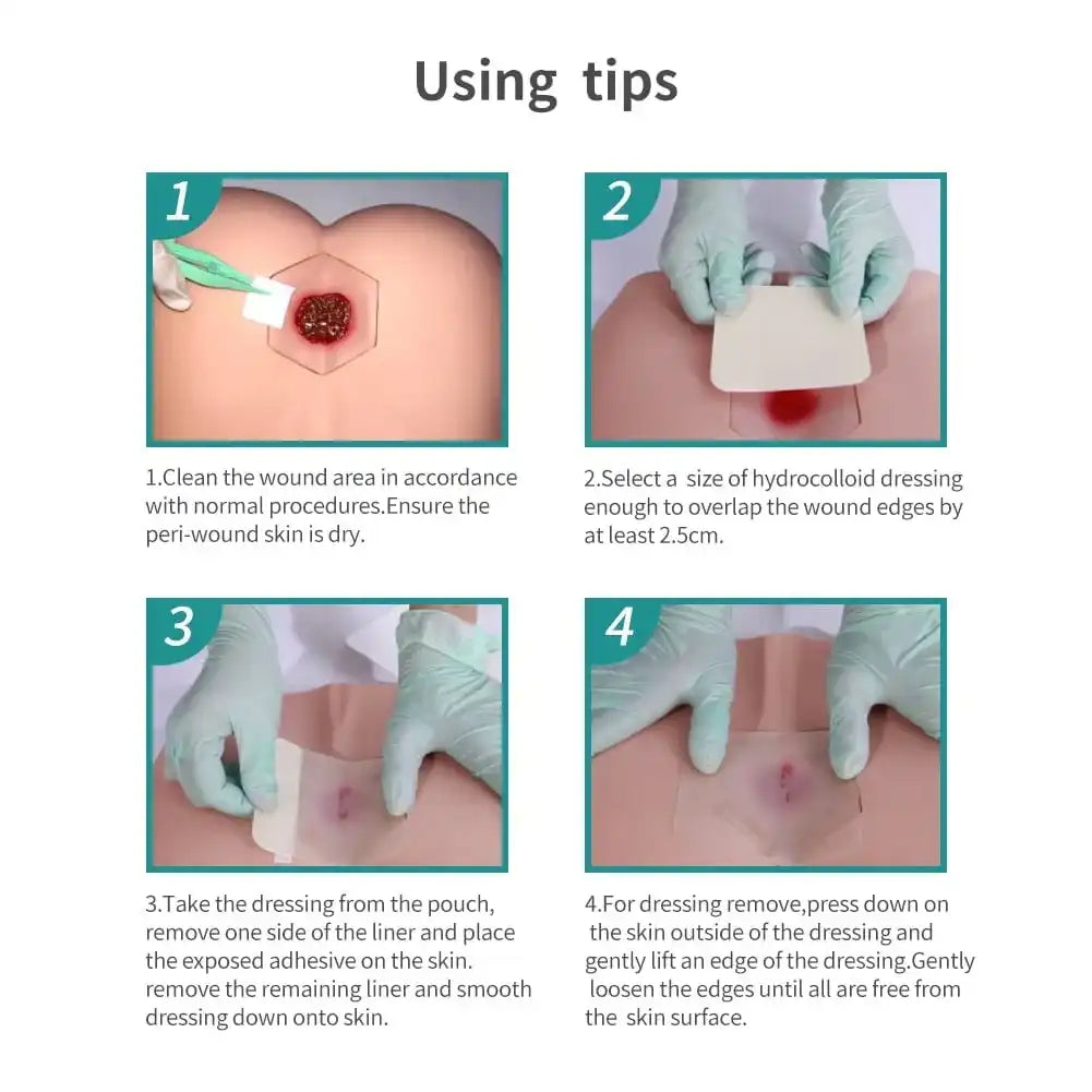 Step-by-step guide for applying hydrocolloid wound dressing with gloved hands on skin model.