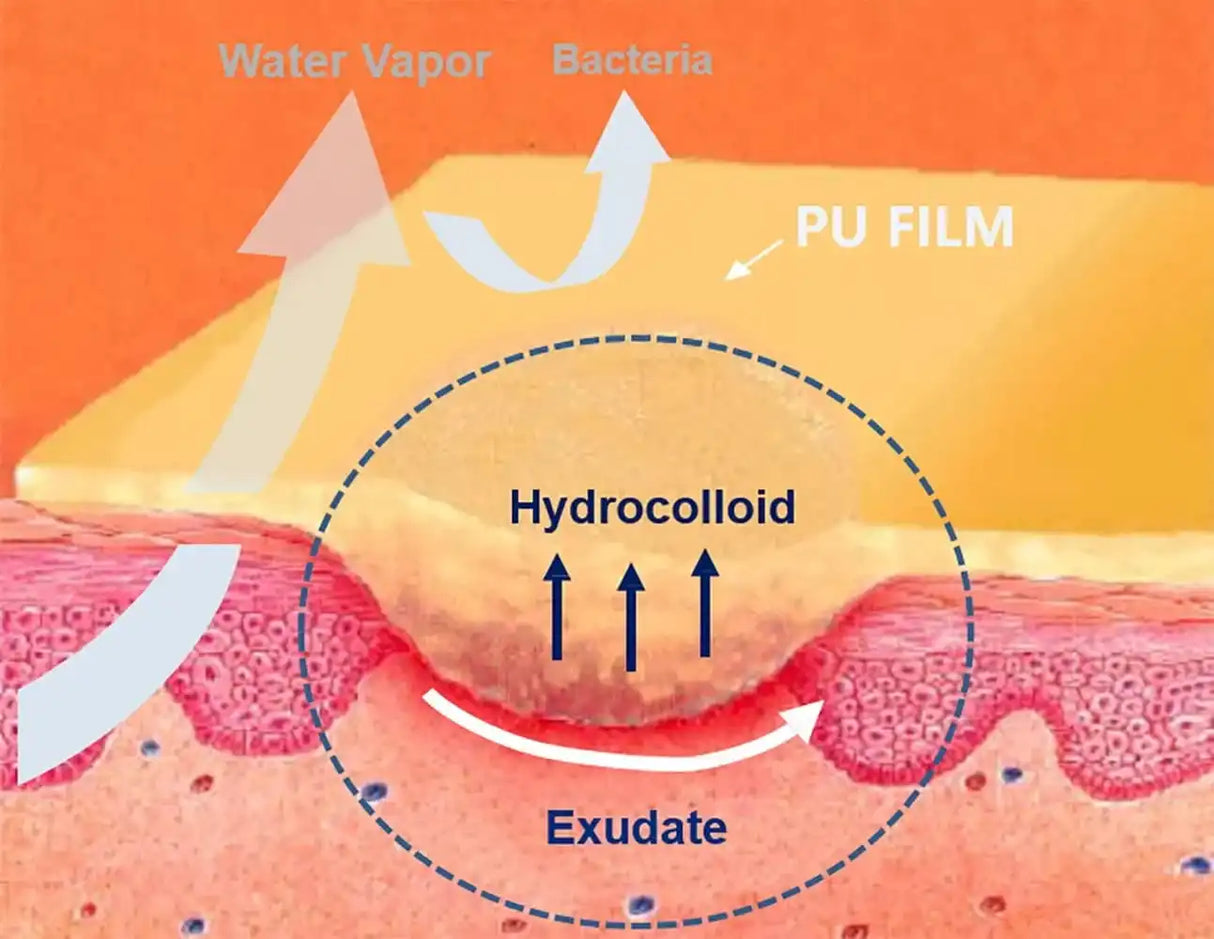 Hydrocolloid wound dressing diagram showing PU film, water vapor, and exudate absorption