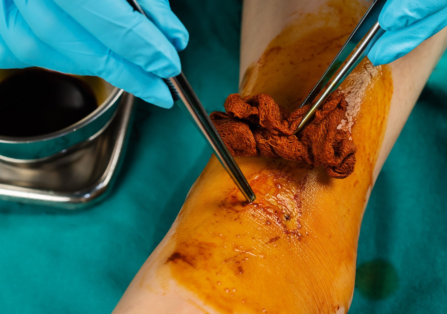 Image Title Alt Image