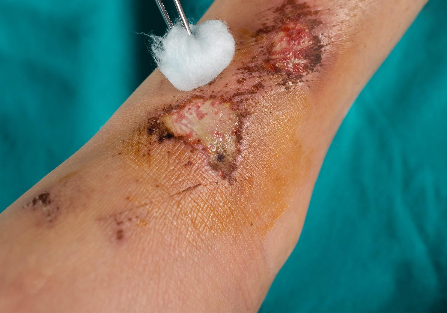 Image Title Alt Image