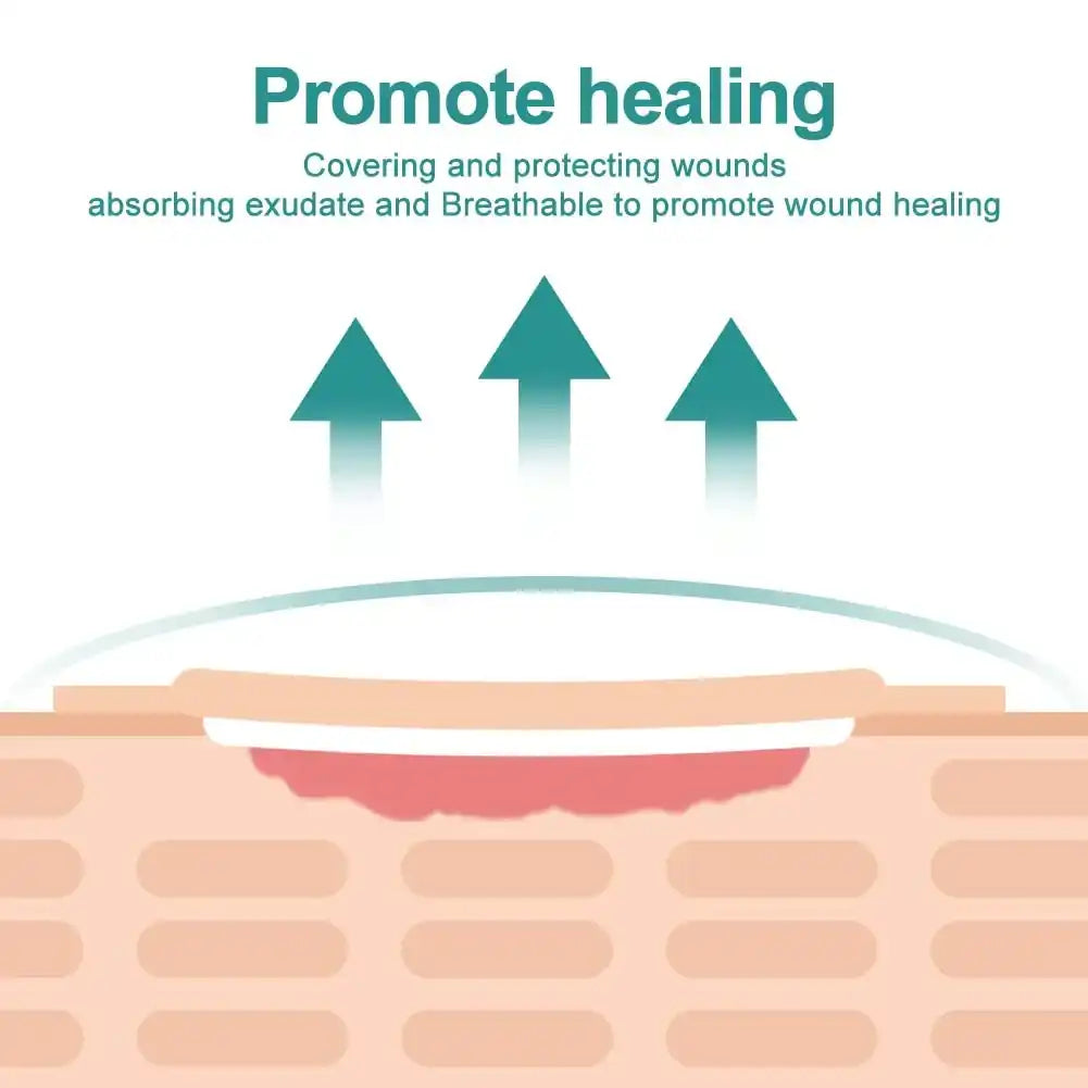 Illustration of a wound dressing promoting healing by covering, absorbing exudate, and allowing breathability