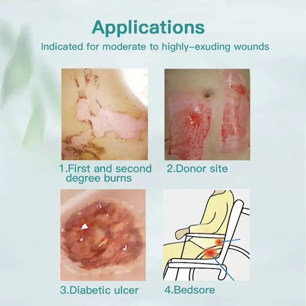 Wound care applications for burns, donor sites, diabetic ulcers, and bedsores illustrated.