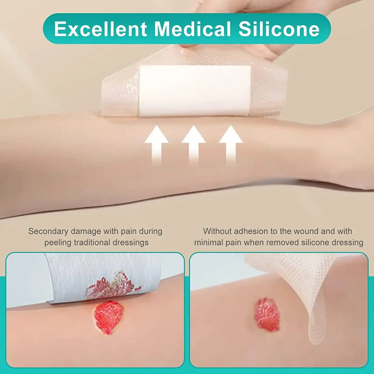 Medical silicone wound dressing being gently removed from an arm, showing less pain and adhesion compared to traditional dressings.