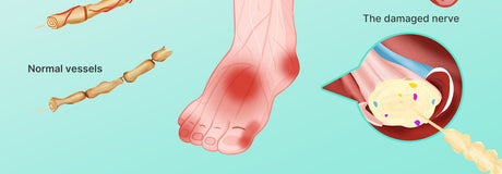 5 Tips You Never Know for Diabetic Foot Care