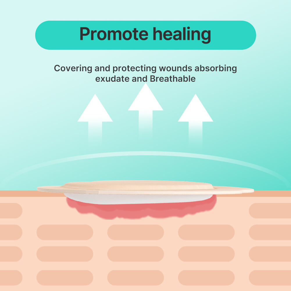 Dimora Sacrum Silicone Foam Adhesive Wound Dressings 7.08 x 7.08inch