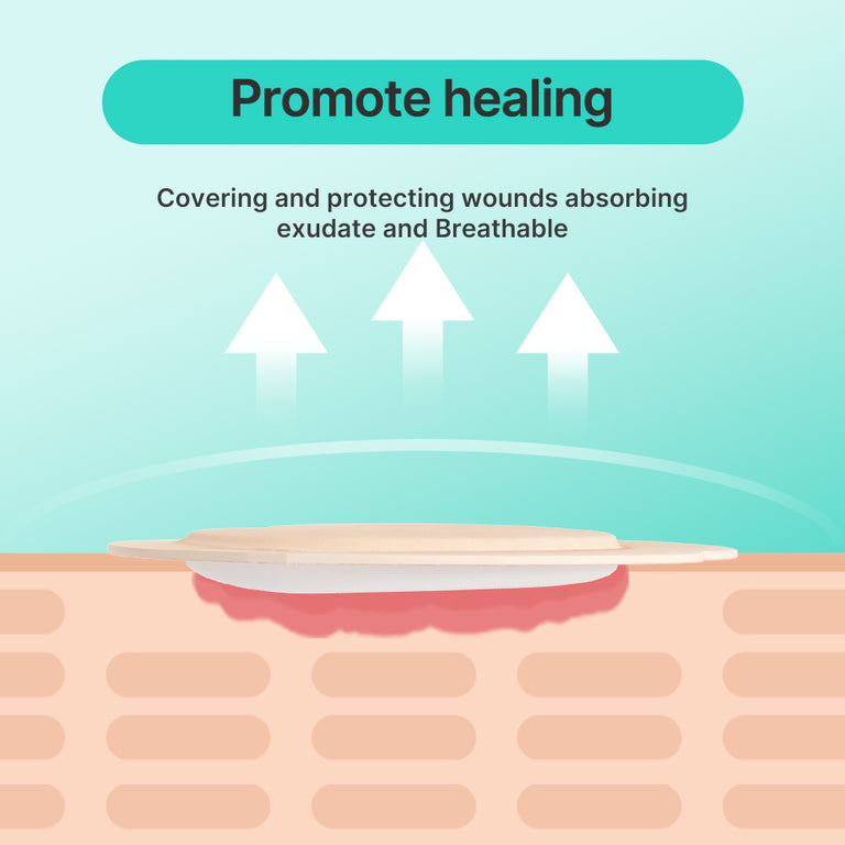 Dimora Sacrum Silicone Foam Adhesive Wound Dressings 7.08 x 7.08inch