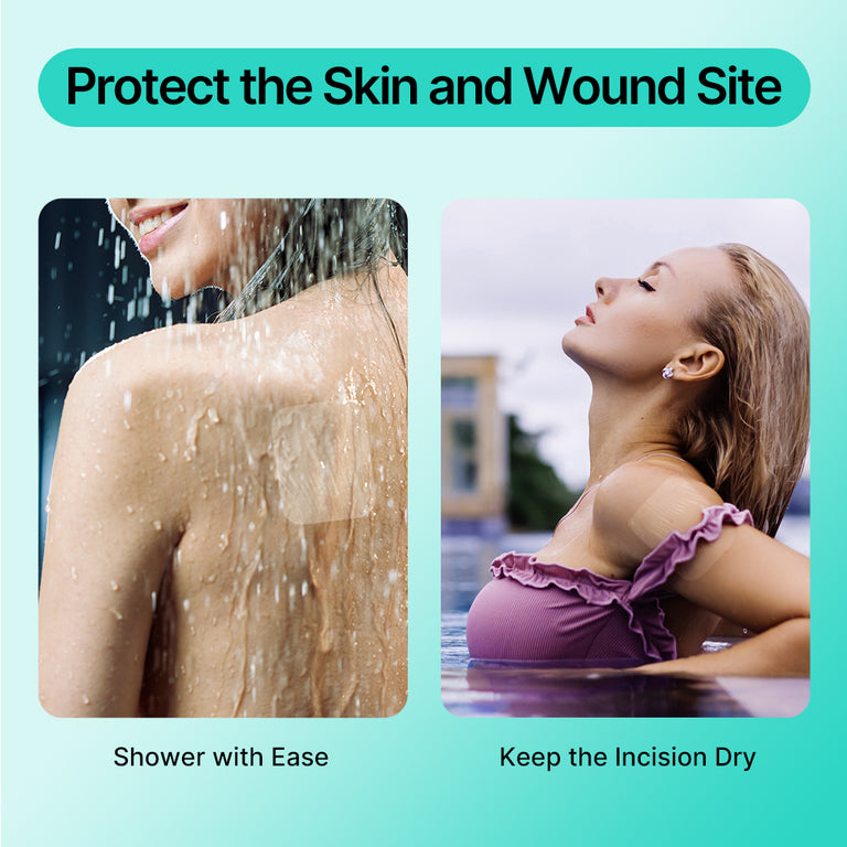 Dimora Transparent Film Dressing with Hypoallergenic Adhesive 6x8 inch