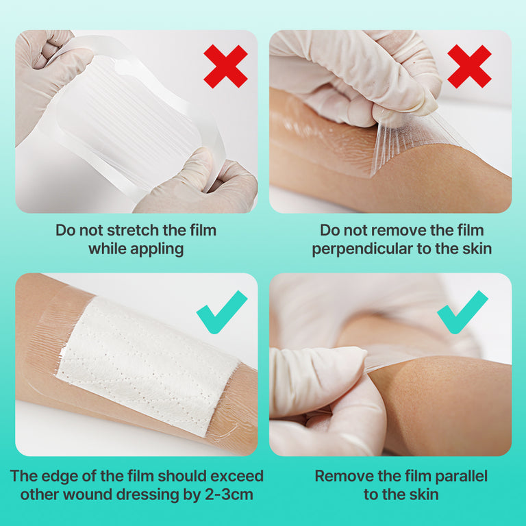 Dimora Transparent Film Dressing, Waterproof Adhesive Bandages 4 x 5 inch