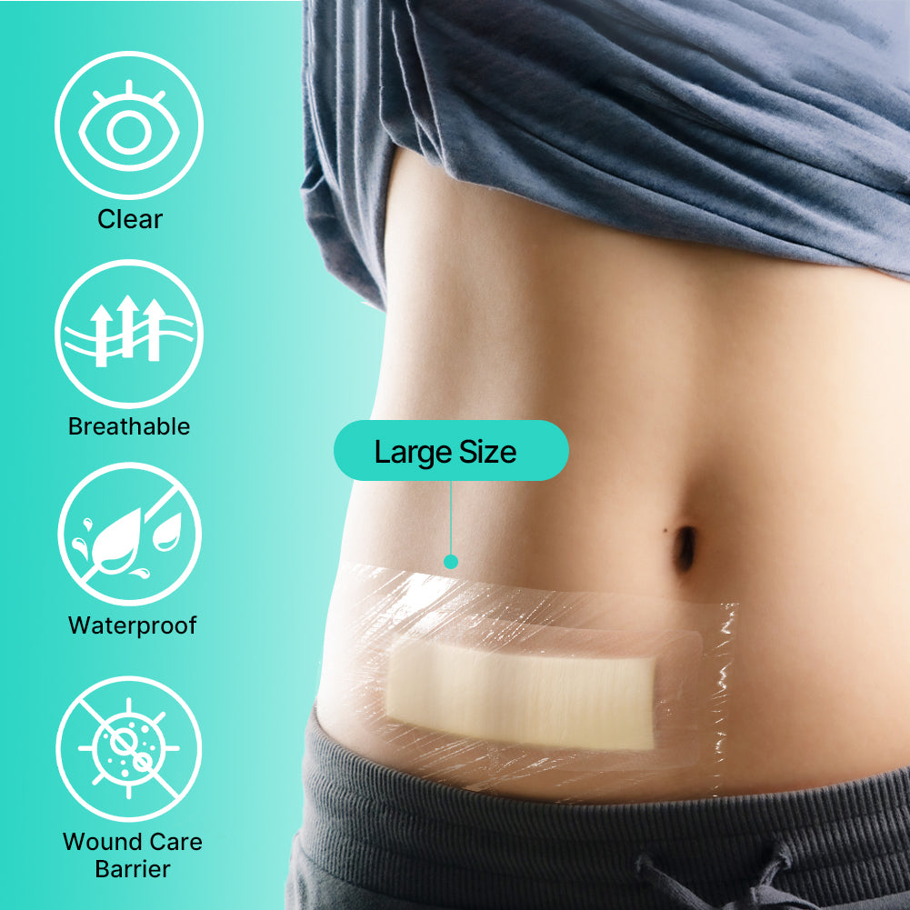 Dimora Transparent Film Dressing with Hypoallergenic Adhesive 6x8 inch