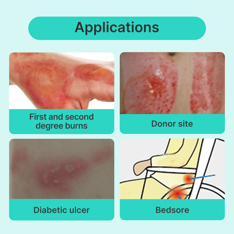 Dimora Silicone Foam Dressing Bordered Foam Wound Dressing