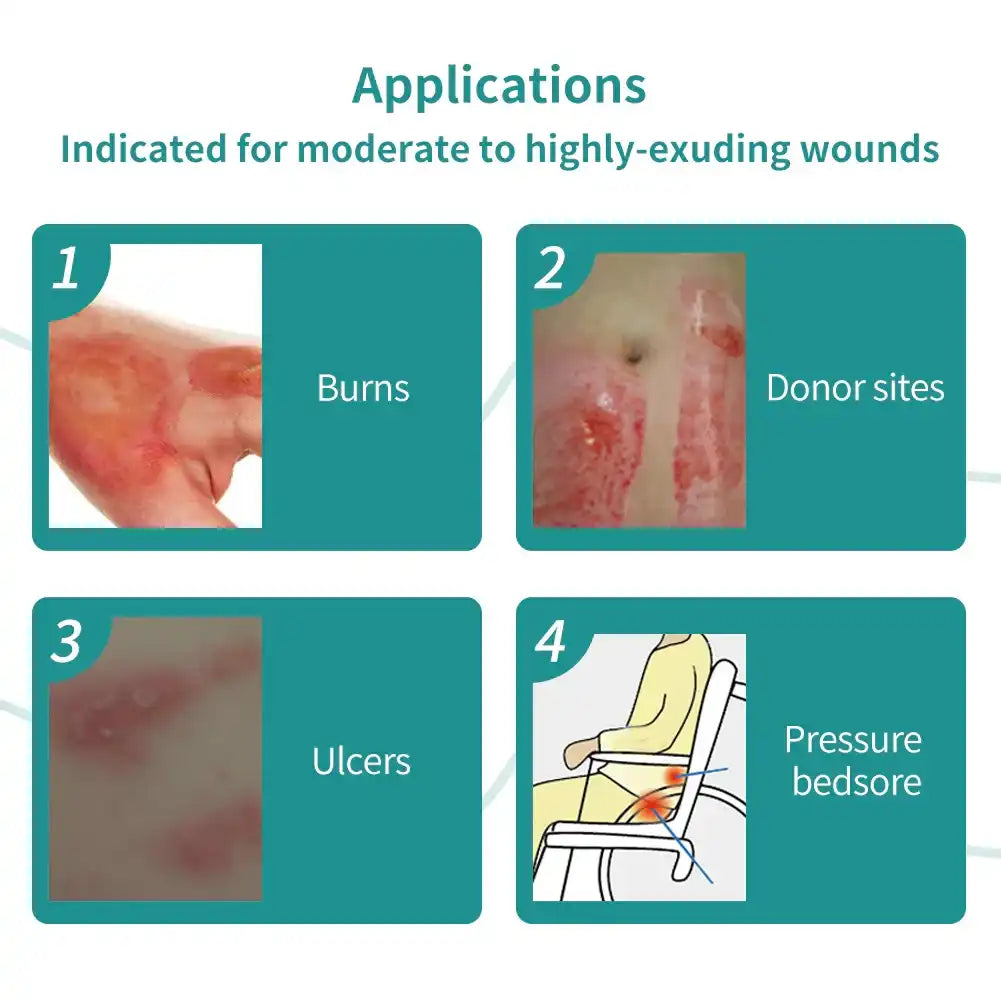 Wound care applications chart showing burns, donor sites, ulcers, and pressure bedsores