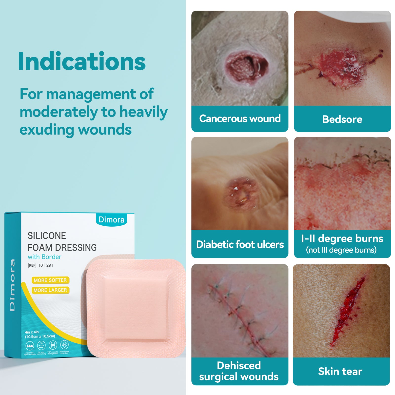 Dimora Ultra Soft Silicone Foam Dressing 4