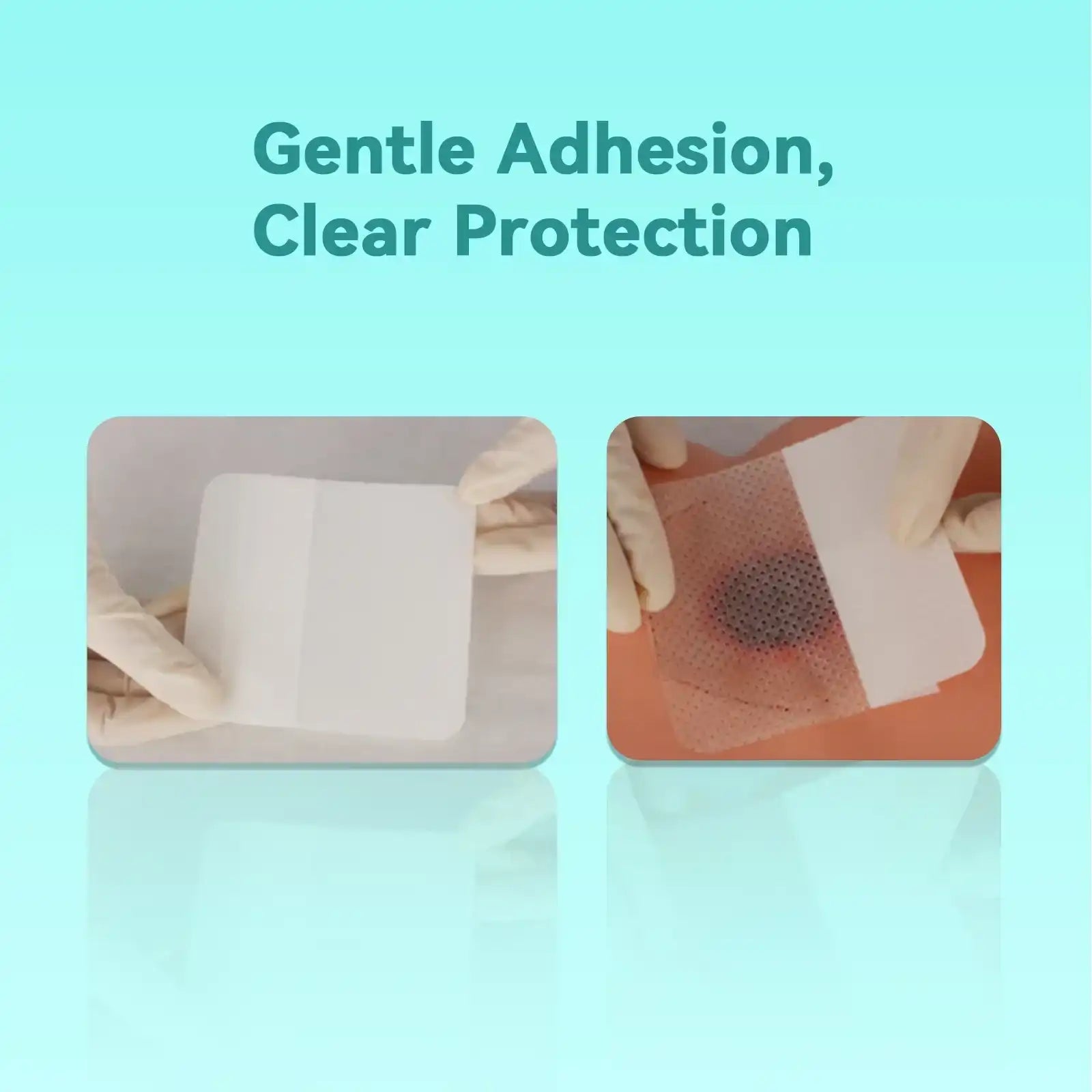 Dimora Silicone Wound Dressing Dimora Silicone Wound Dressing