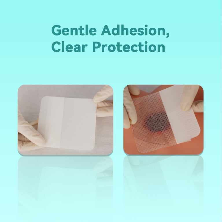 Dimora Silicone Wound Contact Layer, Non-adhering Dressing, Transparent Wound Dressing Pads