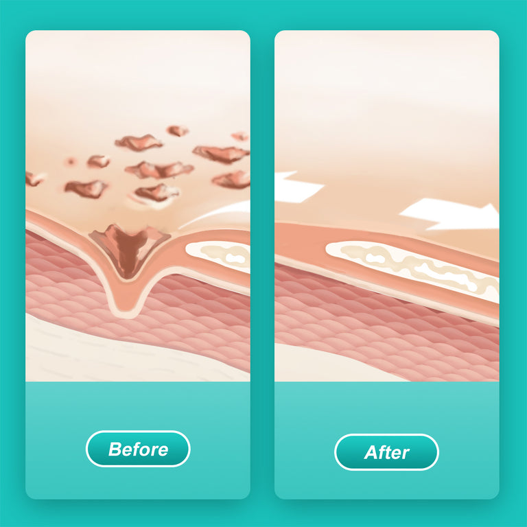 Dimora Hydrogel First Aid Ointment, Burn Injory Soothing Gel