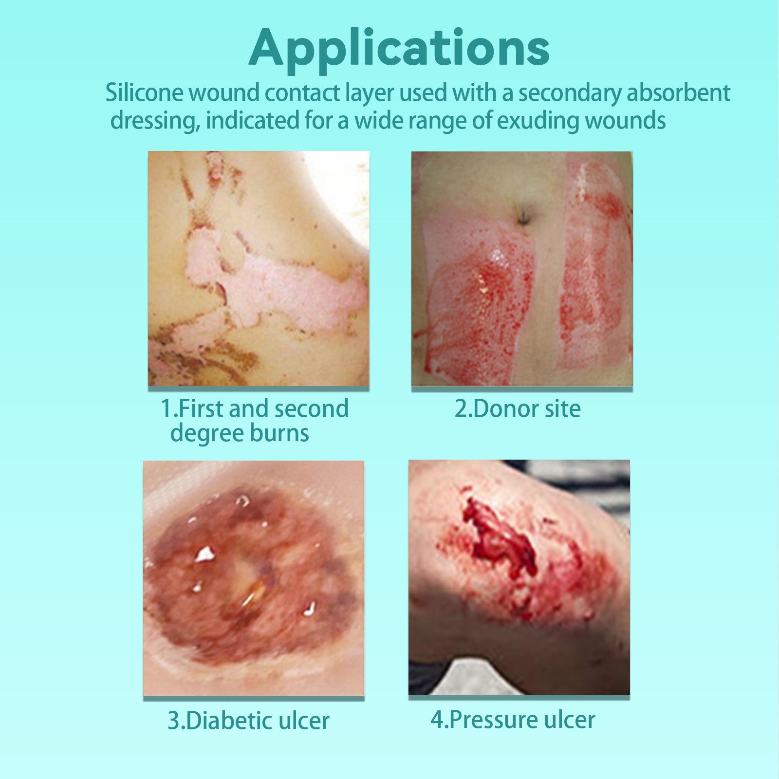 Dimora Silicone Wound Contact Layer, Non-adhering Dressing, Transparent Wound Dressing Pads