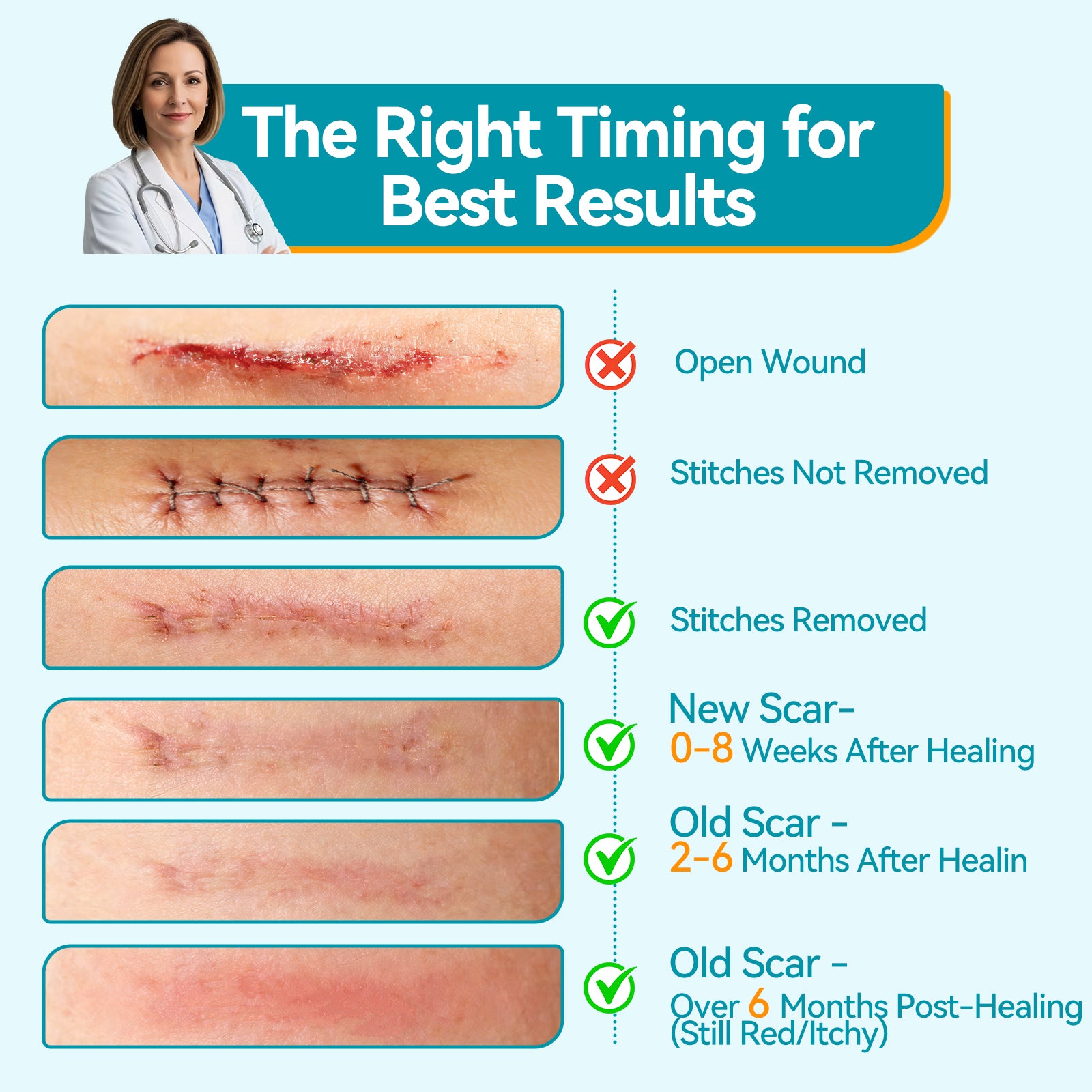 Dimora UPF50+ Silicone Scar Sheets with UV Protection for Surgical, C-Section & Keloid Scars,