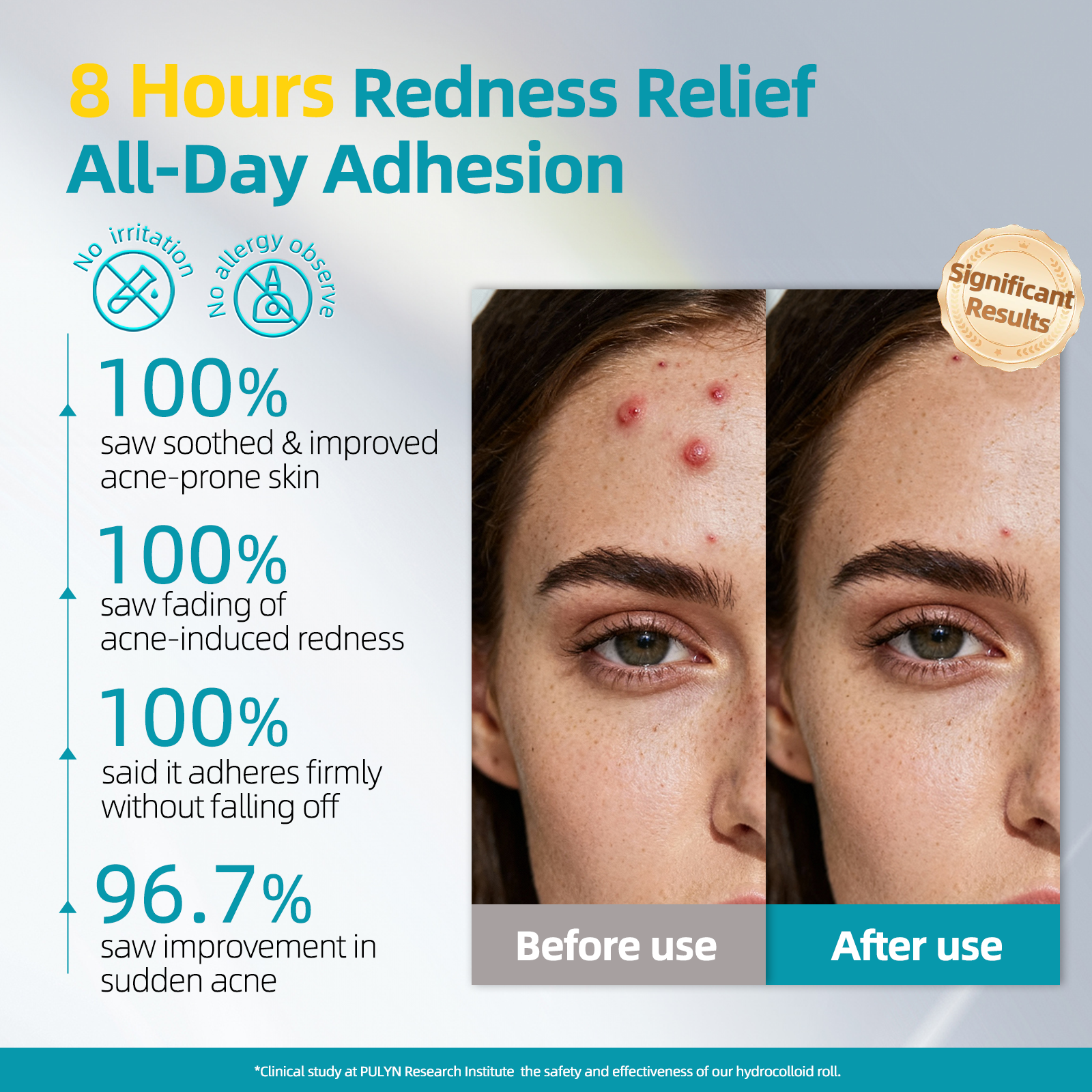 Dimora Medical Grade Hydrocolloid Roll (2in*16ft), Highly Absorbent Hydrocolloid Bandages for Wound Care, Burn, Blister, Acne Care, Waterproof & Cut to Size