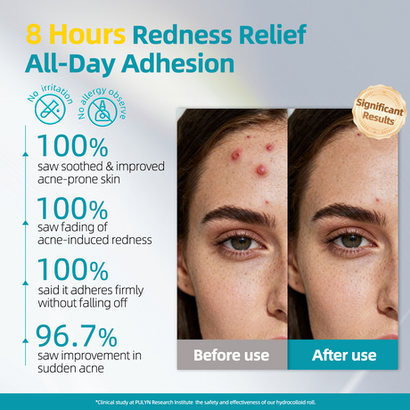 Dimora Medical Grade Hydrocolloid Roll (2in*16ft), Highly Absorbent Hydrocolloid Bandages for Wound Care, Burn, Blister, Acne Care, Waterproof & Cut to Size