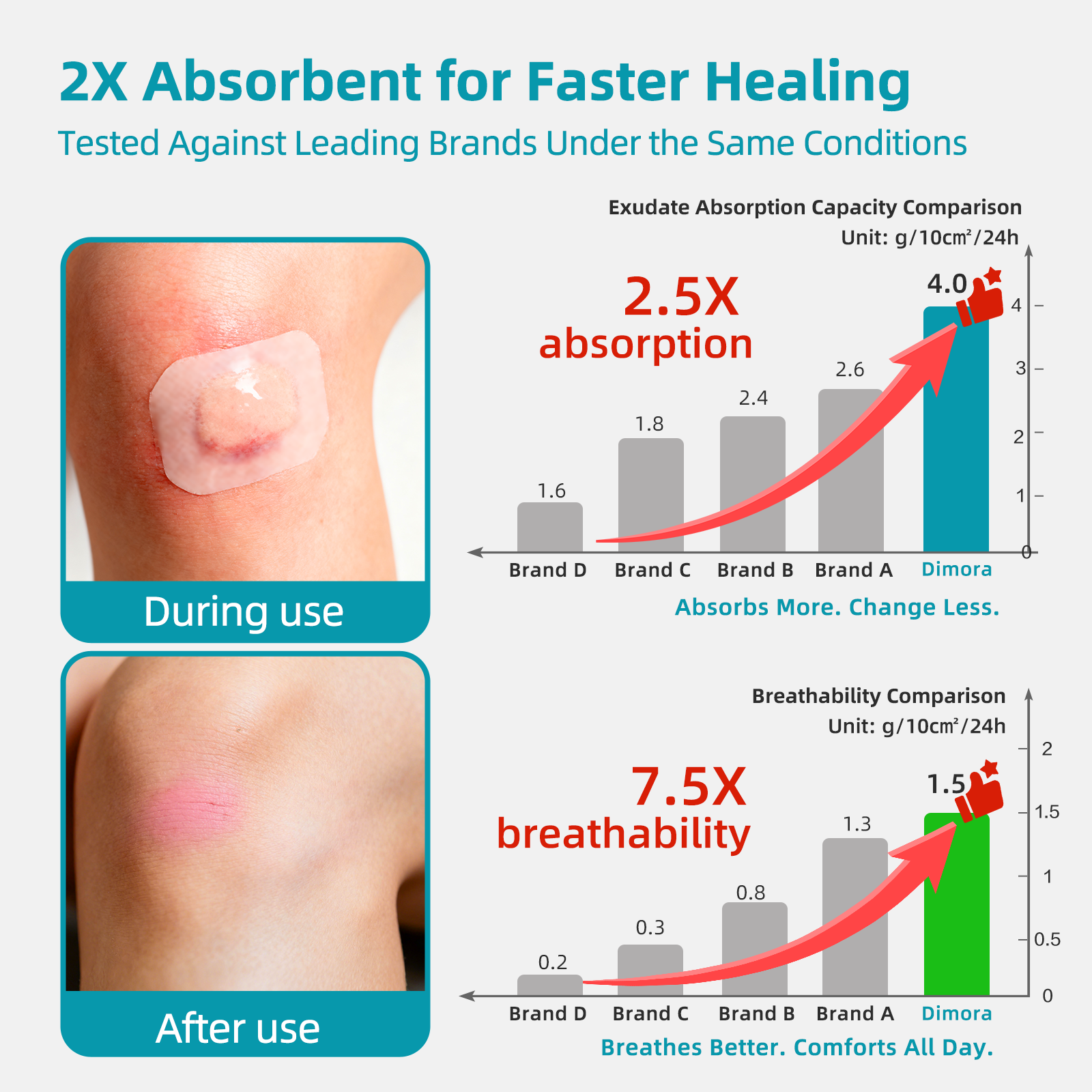 Dimora Medical Grade Hydrocolloid Roll (2in*16ft), Highly Absorbent Hydrocolloid Bandages for Wound Care, Burn, Blister, Acne Care, Waterproof & Cut to Size