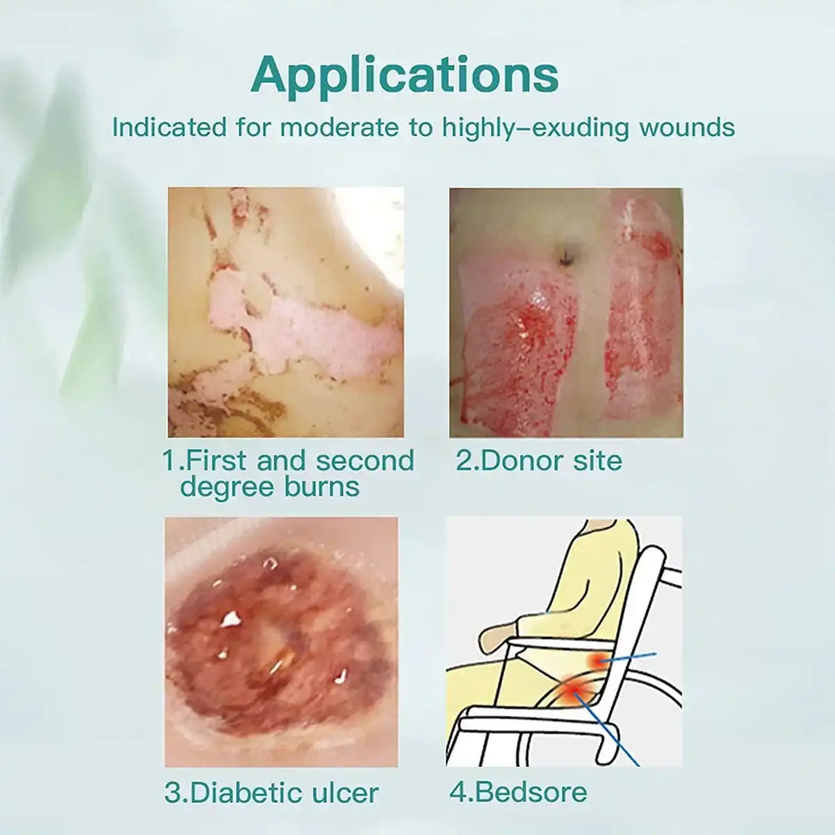 Wound care uses for dressings: burns, donor site wounds, diabetic ulcers, bedsores